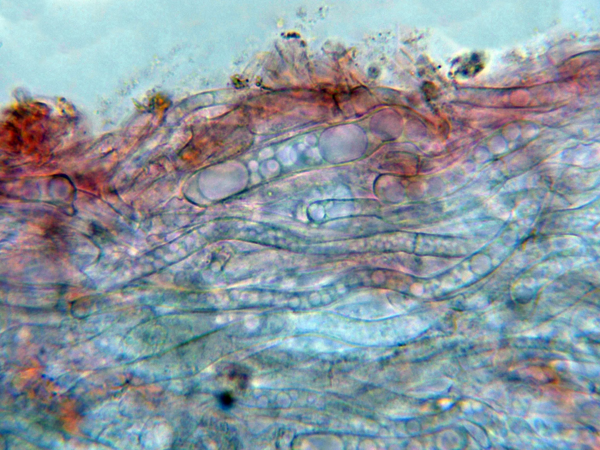 Microscopía de Tephrocybe platypus - 10 - Suprapellis-007